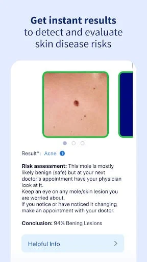 AI Dermatologist: Skin Scanner Screenshot 4