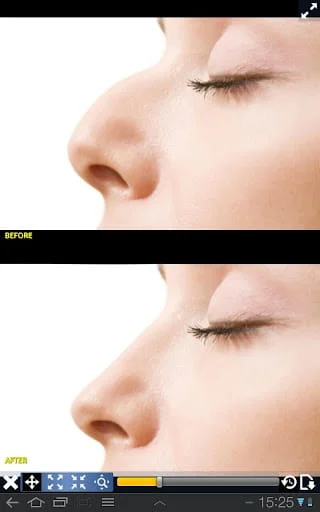 Plastic Surgery Simulator Lite Screenshot 1